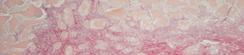 Banner image representing research study in biology. Microscope photograph of cells in pink and red.