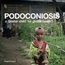 Podoconiosis: a 'poster child' for global health?